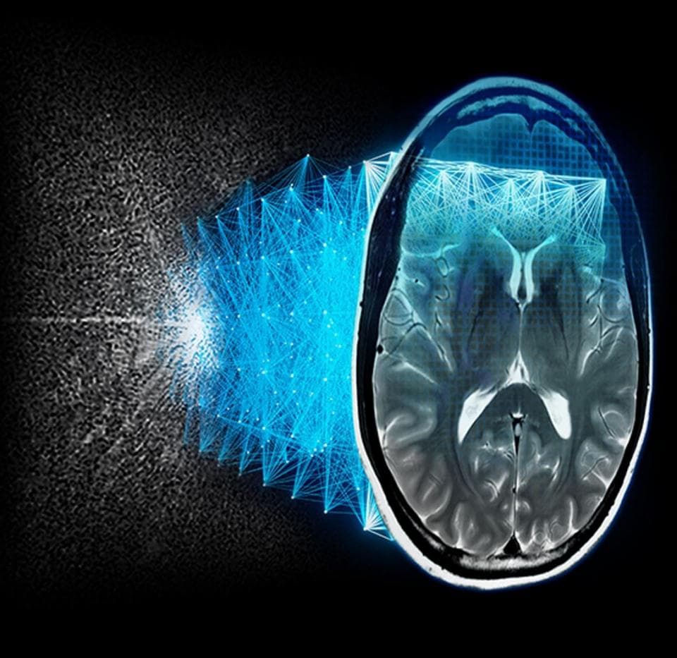医学图像分割示例